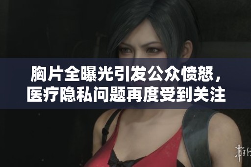 胸片全曝光引发公众愤怒，医疗隐私问题再度受到关注