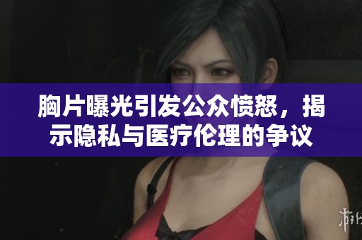 胸片曝光引发公众愤怒，揭示隐私与医疗伦理的争议